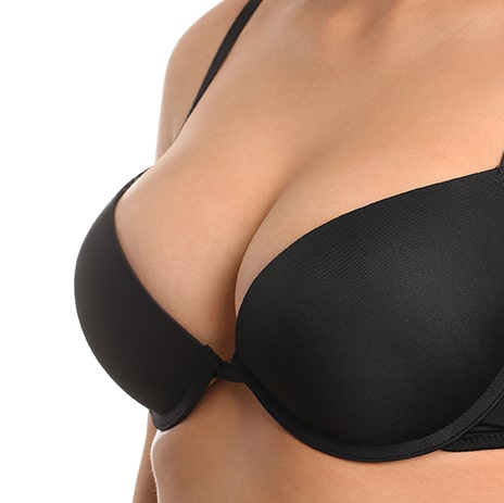 Breast lift in Jackson model with black bra