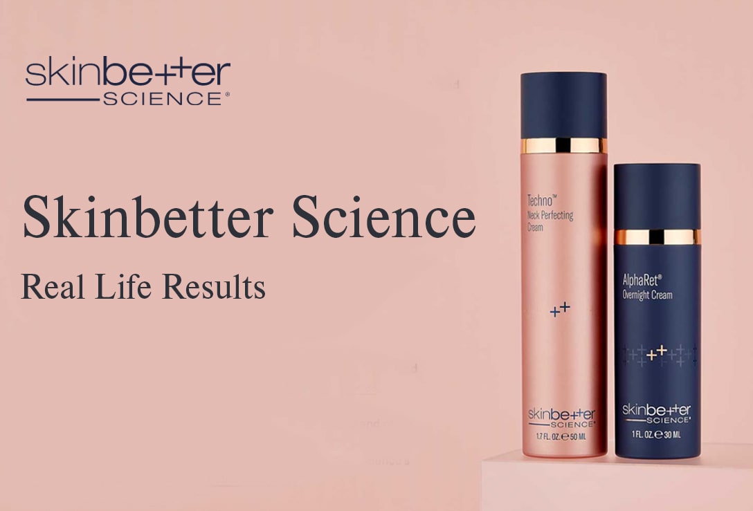 Shop Skinbetter Science